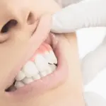 Come prendersi cura del proprio sorriso